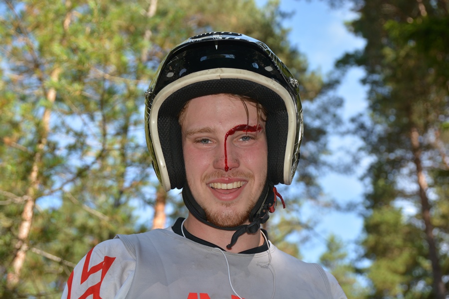 Ole Kristian måtte sy noen sting før det bar ut i skogen igjen for å fullføre! 